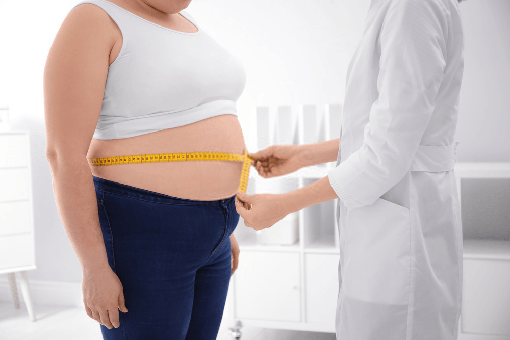 Mide küçültme ameliyatında kilo sınırı nedir?​
